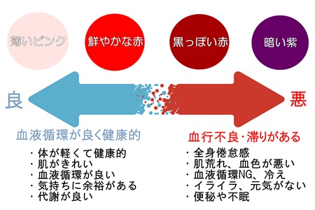 読んで安心 瀉血とは カッピングの種類別の効果と副作用を解説 Have A Good Job