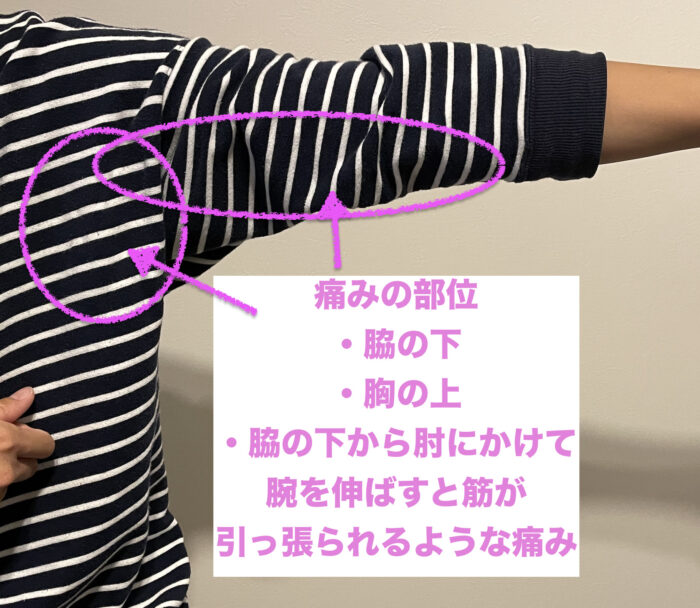 モデルナワクチン1回目の接種後に起きた体調不良をまとめています。妻に起きた症例は接種した腕の裏側全体の筋が引っ張られるような痛み、脇の下の痛み、胸の痛み、下痢、熱、突然の動悸、息切れ、眩暈に悩まされて2週間経った現在も日常生活に支障をきたすほどの体調不良に悩まされています。